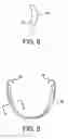 Fig. 04 - COSMETIC PROSTHESIS AND METHODS FOR MAKING THE SAME