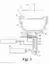 Fig. 04 - Dispensing apparatus and method for semi-solid product