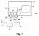 Fig. 02 - Consumable holder with process control apparatus