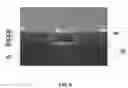 Fig. 10 - III-Nitride Semiconductor Light Emitting Device