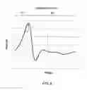 Fig. 06 - Strain and kinetics control during separation phase of imprint process