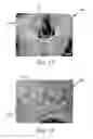 Fig. 10 - METHOD FOR MAKING POLYMERIC WEB EXHIBITING A SOFT AND SILKY TACTILE IMPRESSION