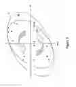 Fig. 03 - Threaded tubular connection which is leak-proof under internal and external successive pressure loads