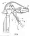 Fig. 11 - EXTENDIBLE REACHER