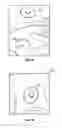 Fig. 04 - Method and system for packaging and mounting surface acoustic wave sensor elements to a flex plate