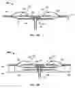 Fig. 08 - Electroactive polymer transducers biased for optimal output