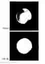 Fig. 06 - Optimized spectral-spatial pulse