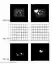 Fig. 08 - Optimized spectral-spatial pulse