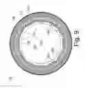 Fig. 10 - PET/MR scanners for simultaneous PET and MR imaging