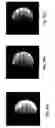 Fig. 09 - Dynamic composite gradient systems for MRI