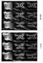 Fig. 10 - Dynamic composite gradient systems for MRI