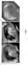 Fig. 11 - Dynamic composite gradient systems for MRI