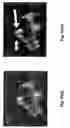 Fig. 12 - Dynamic composite gradient systems for MRI