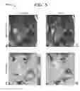 Fig. 05 - Eddy-current artifact reduction in balanced steady-state free precession magnetic resonance imaging