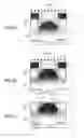 Fig. 06 - Solid-state imaging device and method of manufacturing the same, and imaging apparatus