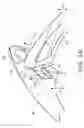 Fig. 07 - Eyeglasses and assembly method thereof
