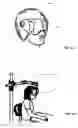 Fig. 14 - Vision modification with reflected image