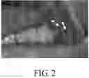 Fig. 03 - Method for analyzing mucosa samples with optical coherence tomography