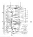 Fig. 02 - MICROSCOPE OBJECTIVE LENS