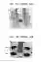 Fig. 03 - LOW-TEMPERATURE-COFIRED-CERAMIC PACKAGE AND METHOD OF MANUFACTURING THE SAME