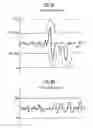 Fig. 04 - xDSL multistandard driver circuit