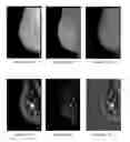 Fig. 09 - Method and apparatus for detecting spiculated masses in mammography
