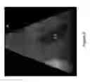 Fig. 09 - Systems and methods for ultrasound simulation using depth peeling