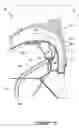 Fig. 04 - Particle separator and separating method for gas turbine engine
