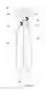 Fig. 12 - Retractable composite rotor blade assembly