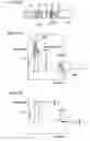 Fig. 15 - Chromatography quantitative measuring apparatus