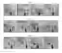 Fig. 05 - TEETH WHITENING FUNCTIONAL MATERIALS DELIVERY SYSTEM