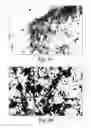 Fig. 05 - Methods of treating Parkinson's disease using viral vectors