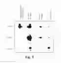 Fig. 07 - Methods of treating Parkinson's disease using viral vectors