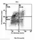 Fig. 10 - Method for preventing and treating cardiovascular diseases with BRCA1