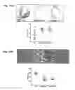 Fig. 19 - Method for preventing and treating cardiovascular diseases with BRCA1