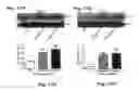 Fig. 29 - Method for preventing and treating cardiovascular diseases with BRCA1