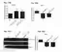 Fig. 31 - Method for preventing and treating cardiovascular diseases with BRCA1