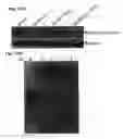 Fig. 45 - Method for preventing and treating cardiovascular diseases with BRCA1