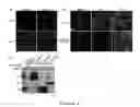 Fig. 02 - Botulinum neurotoxin E receptors and uses thereof
