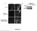 Fig. 08 - Botulinum neurotoxin E receptors and uses thereof