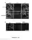 Fig. 14 - Botulinum neurotoxin E receptors and uses thereof