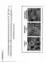 Fig. 05 - Methods of impairing osteoclast differentiation using antibodies that bind siglec-15