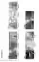 Fig. 11 - Methods of impairing osteoclast differentiation using antibodies that bind siglec-15