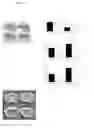 Fig. 06 - CD200 and its receptor, CD200R, modulate bone mass via the differentiation of osteoclasts