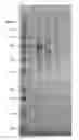 Fig. 01 - Methods of modulating the negative chemotaxis of immune cells