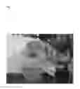 Fig. 05 - Pathogen for bacterial poultry disease