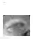 Fig. 06 - Pathogen for bacterial poultry disease