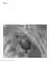 Fig. 08 - Pathogen for bacterial poultry disease
