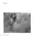 Fig. 11 - Pathogen for bacterial poultry disease
