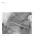 Fig. 12 - Pathogen for bacterial poultry disease